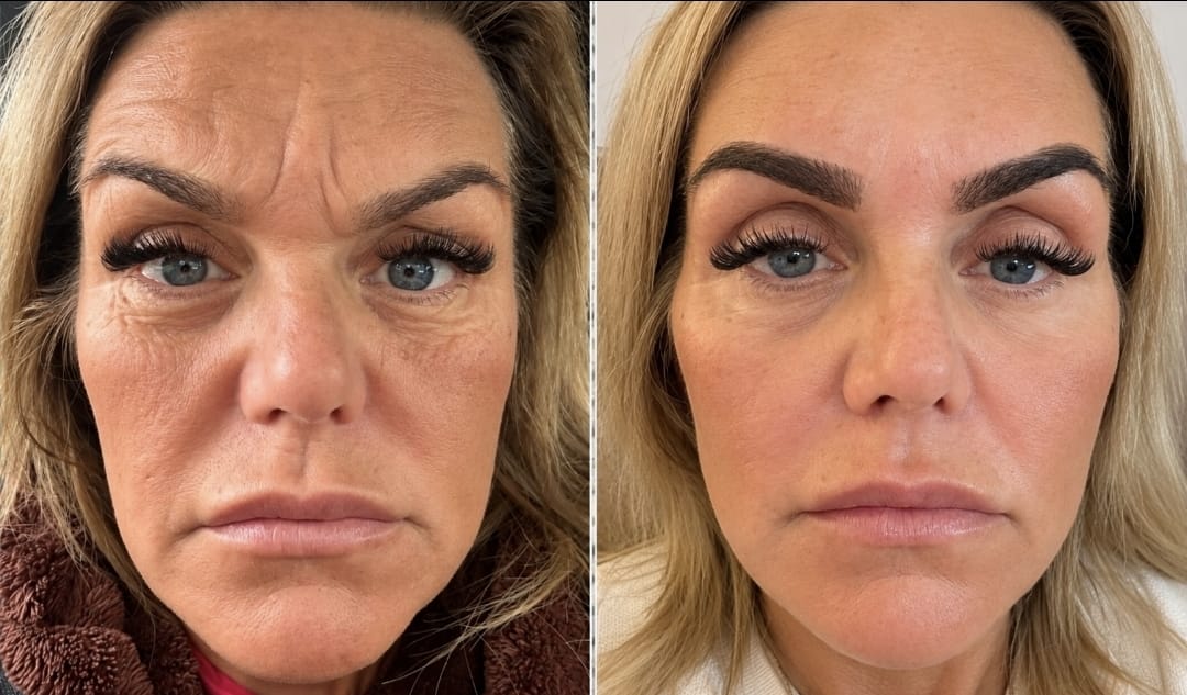 Before and after client portrait shared by Aesthetics by D